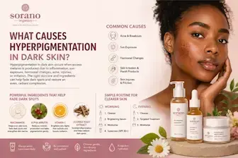 Woman with dark skin showing hyperpigmentation on her cheek alongside skincare ingredients and routine tips for treating dark spots naturally.